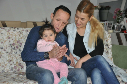 Yüz nakli olan Sert cezaevinde