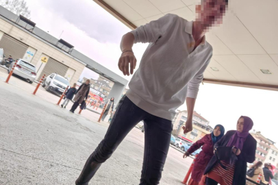 Bursa'da sevgilisinin abisi önce darp etti, sonra biber gazı sıktı