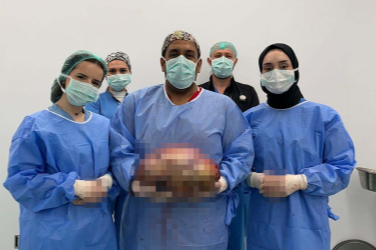 Bursa'da hayat kurtaran ameliyat: 10 kiloluk kitle başarıyla çıkarıldı