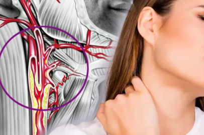 "Şah damarı hastalıkları felç riskini artırıyor"