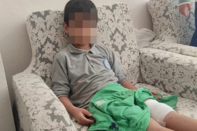 Orhangazi’de 8 yaşındaki çocuğa sokak köpeği saldırdı