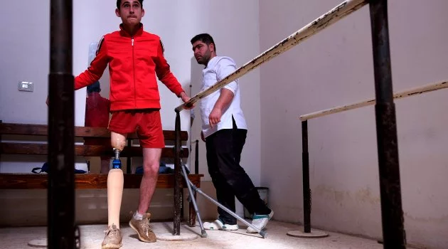 Bombardımanda bacağını kaybeden Nur, protezine kavuştu