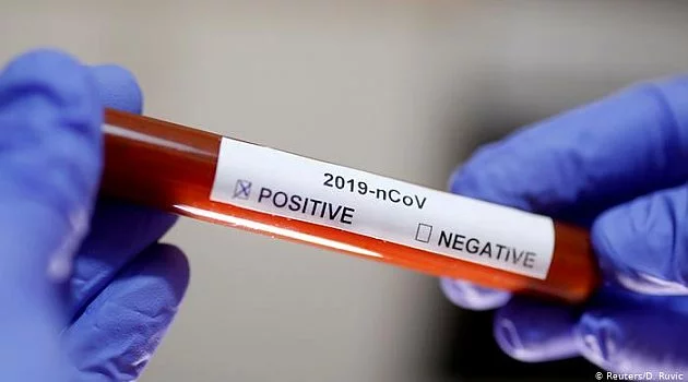 Sağlık Bakanlığı: “Koronavirüs testi yaptırmış vatandaşlarımız test sonuçlarına eNabız uygulamasından ulaşabilir”